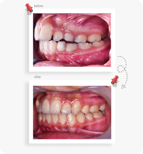 ارتودنسی ثابت