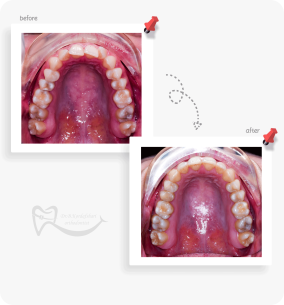 ارتودنسی ثابت